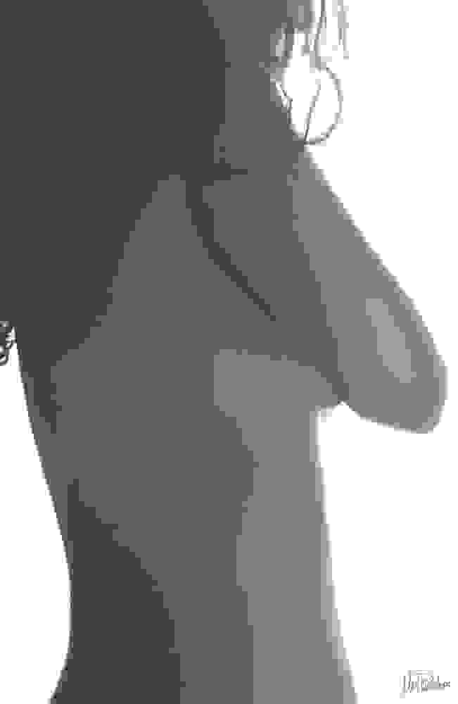 4.esthisis