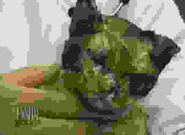 gata-1