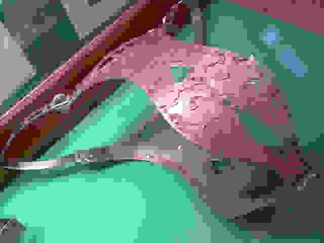 252