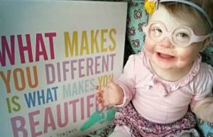 Η κόρη μου έχει σύνδρομο Down...