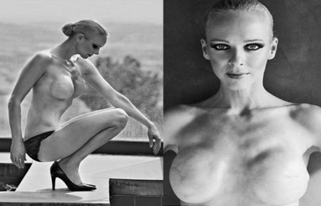 Claire Farwell : «Δε μου λείπουν οι θηλές μου!»