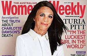 Η γυναίκα που «ξεγέλασε» το θάνατο